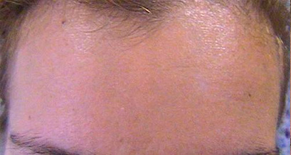 dermatologo